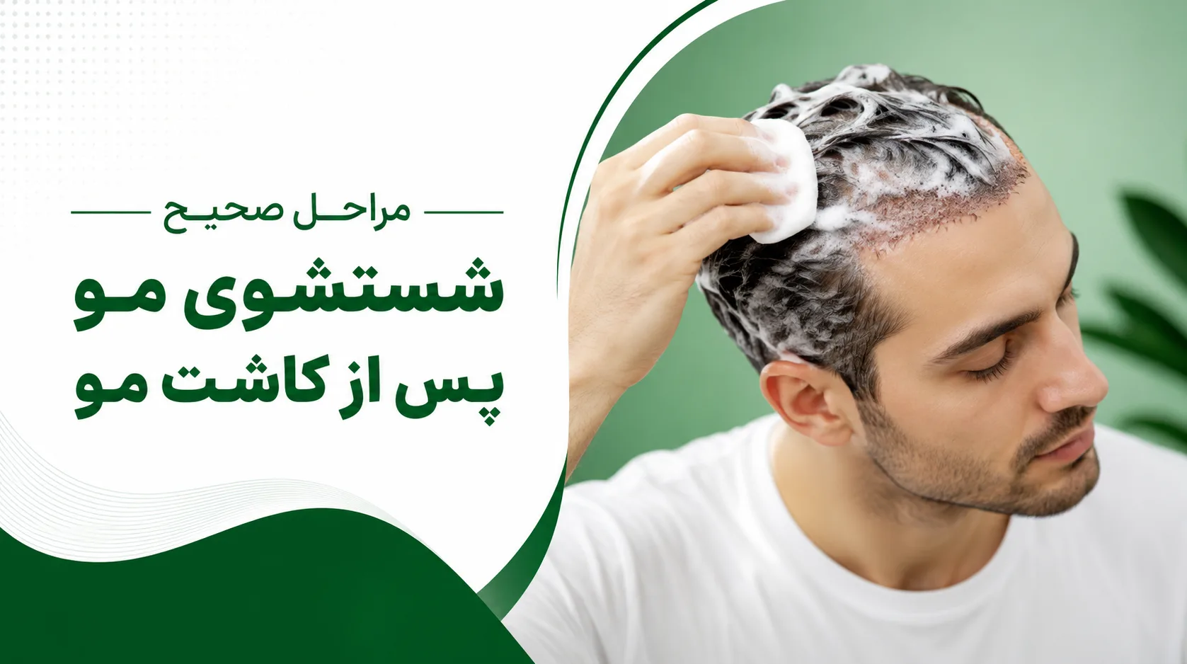 مراحل صحیح شستشوی مو پس از کاشت مو